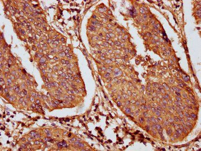 Krt18 Antibody