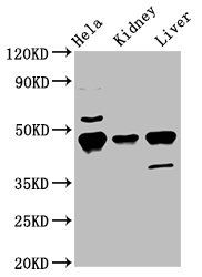 Krt18 antibody