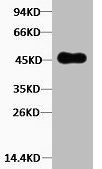 KRT18 Antibody