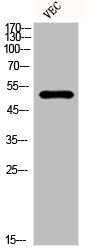 KRT18 Antibody
