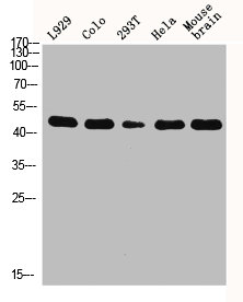 KRT18 Antibody