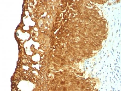 Cytokeratin 19 (KRT19) (Pancreatic Stem Cell Marker) Antibody