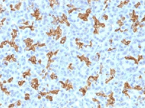 KRT19 antibody