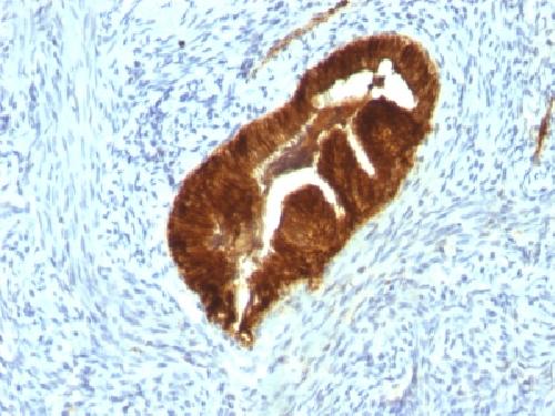 Cytokeratin 19 (KRT19) (Pancreatic Stem Cell Marker) Antibody