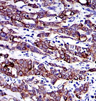 KRT19 Antibody