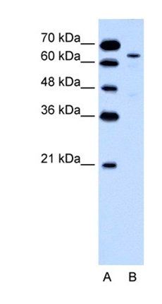 KRT2 antibody
