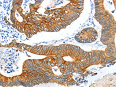 KRT2 Antibody