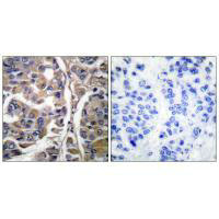 KRT20 antibody