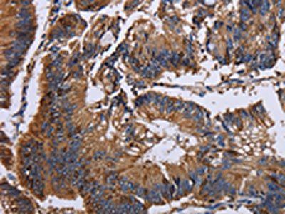 KRT31 Antibody