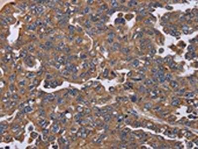 KRT31 Antibody