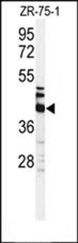 KRT35 antibody