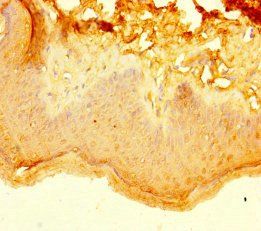 KRT40 Antibody