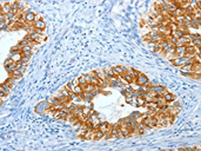KRT40 Antibody
