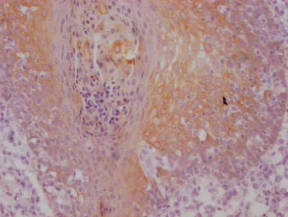 KRT5/KRT6A Monoclonal Antibody