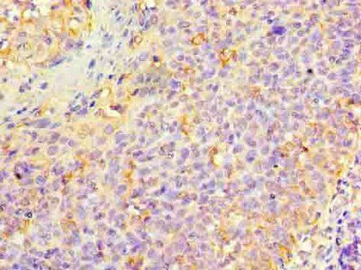 KRT6A Antibody