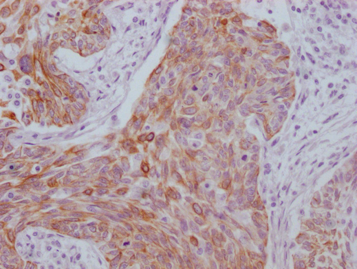KRT6A Antibody