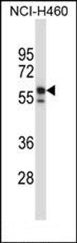 KRT6B antibody