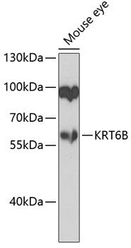 KRT6B antibody