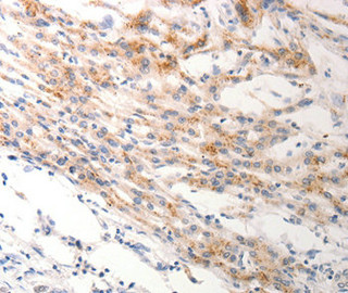 KRT6B Antibody