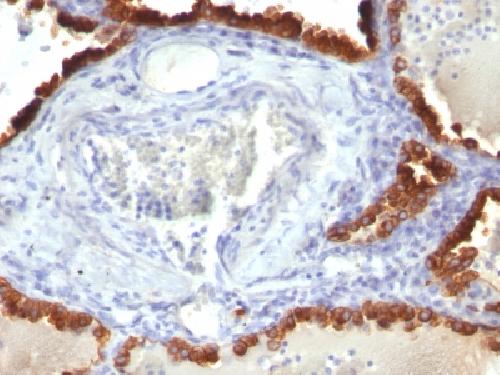 Cytokeratin 7 (Glandular and Transitional Epithelial Marker) Antibody