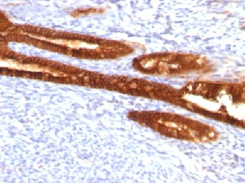 Cytokeratin 7 (Glandular and Transitional Epithelial Marker) Antibody