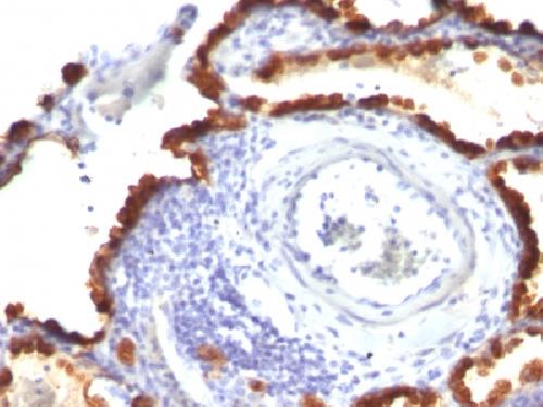 Cytokeratin 7 (Glandular and Transitional Epithelial Marker) Antibody