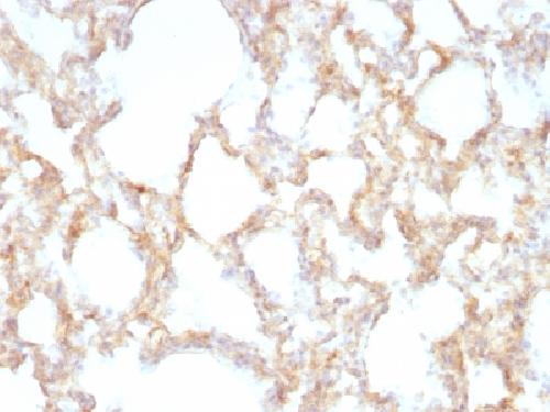 Cytokeratin 7 (Glandular and Transitional Epithelial Marker) Antibody