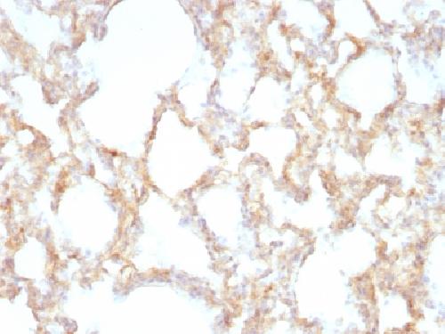 KRT7 antibody