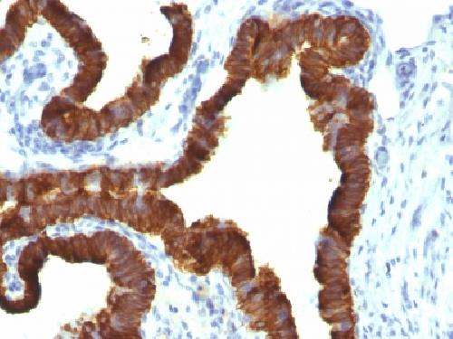Cytokeratin 7 (Glandular and Transitional Epithelial Marker) Antibody
