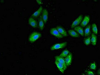 KRT7 Antibody