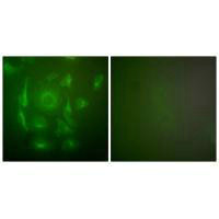 KRT7 Antibody