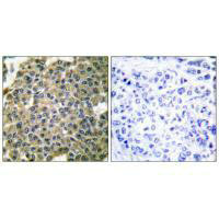 KRT7 Antibody
