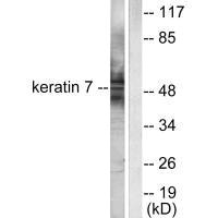 KRT7 antibody