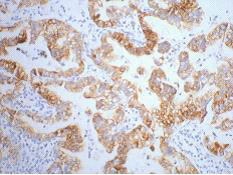 KRT7 antibody