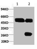 KRT7 Monoclonal Antibody