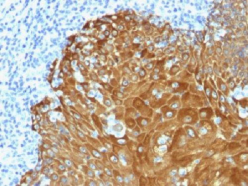 Cytokeratin, pan (Epithelial Marker) Antibody