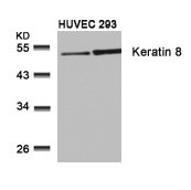 KRT8 (Ab-74) antibody