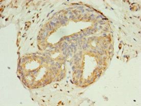 KRT8 Antibody