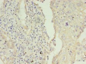KRT8 Antibody