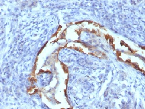 KRT8 Antibody