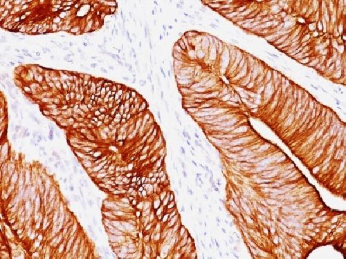 KRT8 Antibody