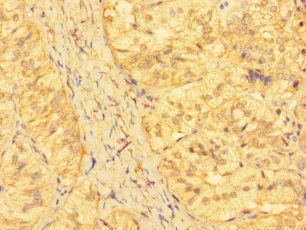 KRTAP23-1 Antibody