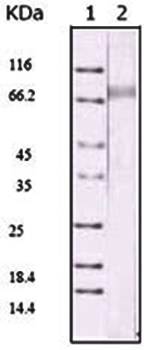 KSHV ORF45 Antibody