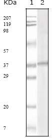 KSHV ORF62 Antibody