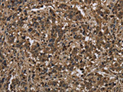 KSR1 Antibody