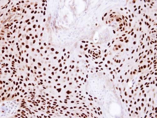 Ku80 antibody [N3C2], Internal
