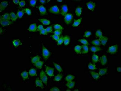 KY Antibody