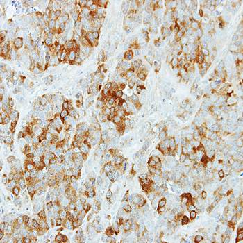 KYNU Rabbit Polyclonal Antibody