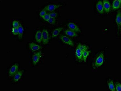 Kynurenine 3-monooxygenase antibody