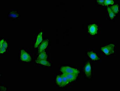 L-lactate dehydrogenase A chain antibody